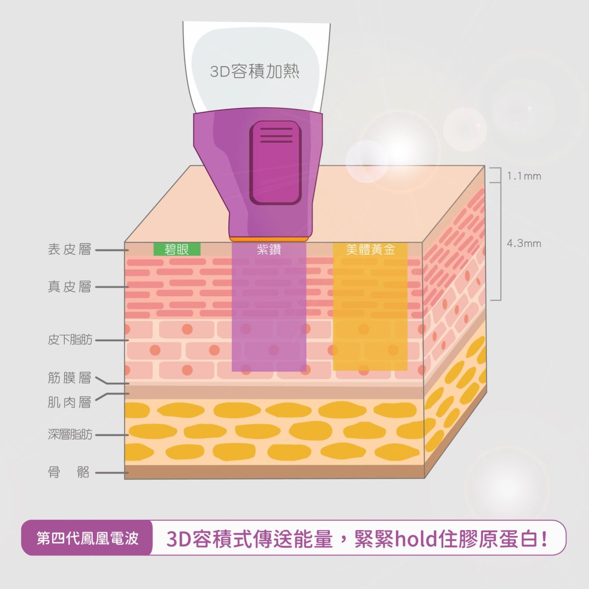 高雄湞媄診所第四代鳳凰電波容積式加熱